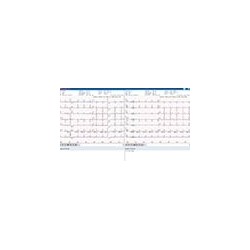 INTERMED ELETTROCARDIOGRAFO DIGITALE INTERPRETATIVO 12 DERIVAZIONI A 12 CANALI SU BASE PERSONAL COMPUTER-ECG2000