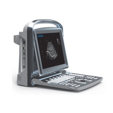 CHISON ECOGRAFO PORTATILE CHISON ECO1