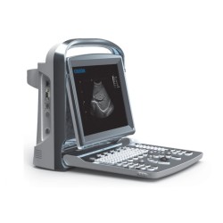 CHISON ECOGRAFO PORTATILE CHISON ECO1