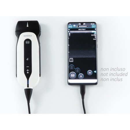 GIMA SONOEYE P2 DOPPLER DIGITALE A COLORI - SONDA LINEAR ARRAY