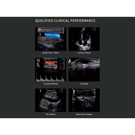 GIMA SONOEYE P2 DOPPLER DIGITALE A COLORI - SONDA LINEAR ARRAY