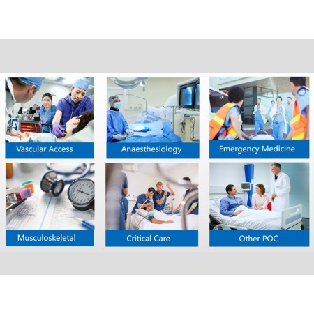 GIMA SONOEYE P2 DOPPLER DIGITALE A COLORI - SONDA LINEAR ARRAY