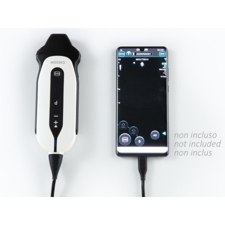 GIMA SONOEYE P3 DOPPLER DIGITALE A COLORI - SONDA PHASE ARRAY