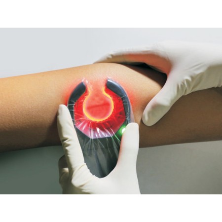 VEINSPY DISPOSITIVO PORTATILE PER LA VISUALIZZAZIONE DELLE VENE