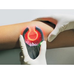 VEINSPY DISPOSITIVO PORTATILE PER LA VISUALIZZAZIONE DELLE VENE