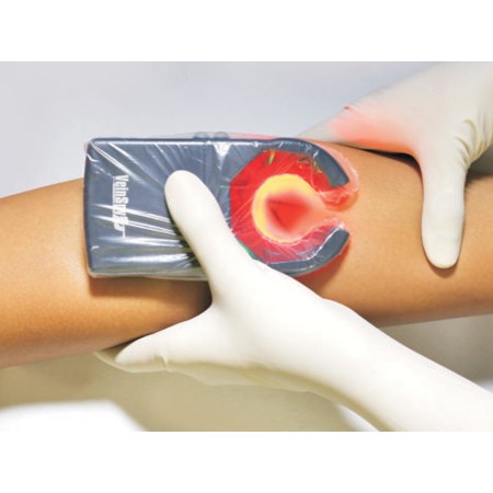 VEINSPY DISPOSITIVO PORTATILE PER LA VISUALIZZAZIONE DELLE VENE