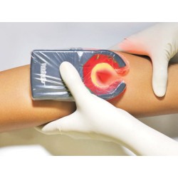 VEINSPY DISPOSITIVO PORTATILE PER LA VISUALIZZAZIONE DELLE VENE