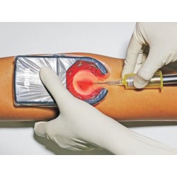 VEINSPY DISPOSITIVO PORTATILE PER LA VISUALIZZAZIONE DELLE VENE