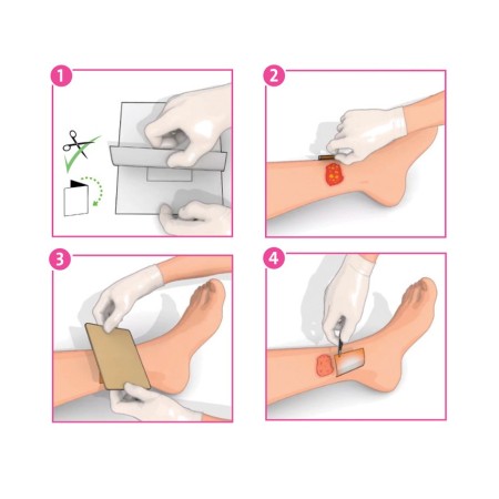 3M INADINE +KCI MEDICAIZONE NON ADESIVA 5x5 CM (CONF. 25 PZ.)