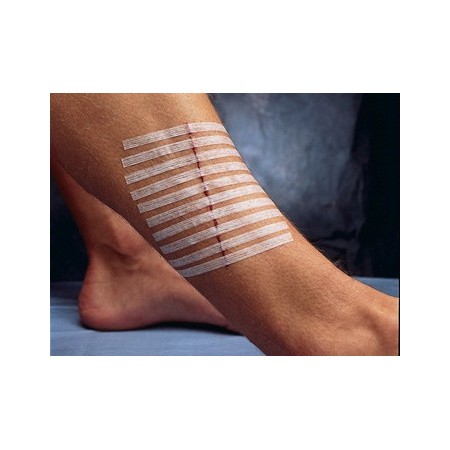 3M STERI-STRIP 3M - 100 x 6MM  (CONF. 50 PZ DA 10 STRIP)