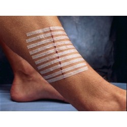 3M STERI-STRIP 3M - 100 x 6MM  (CONF. 50 PZ DA 10 STRIP)