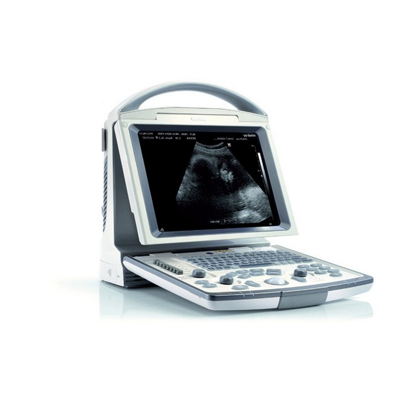 MINDRAY ECOGRAFO PORTATILE MINDRAY DP-20 - SCHERMO 12 - SENZA SONDA 