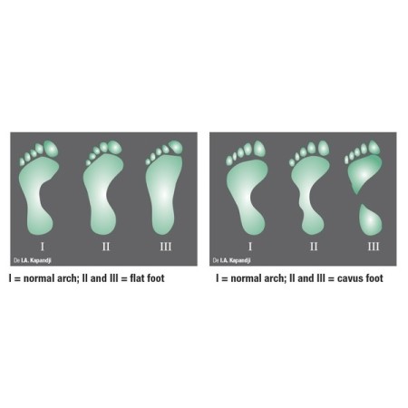 CHINESPORT PODOSCOPIO "LUX NEW" A LED