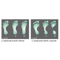 CHINESPORT PODOSCOPIO "LUX NEW" A LED