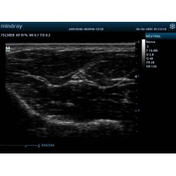 NUOVO MINDRAY ECOGRAFO PORTATILE MINDRAY "DP-10" - SCHERMO 12" - SENZA SONDA
