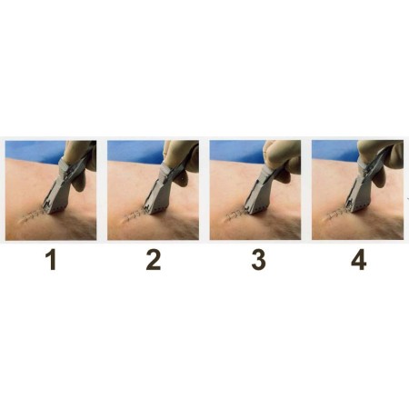 GIMA SUTURATRICE CUTANEA DI PRECISIONE 3M -MODELLI DIVERSI  - STERILE CONFZ. 12 PZ.
